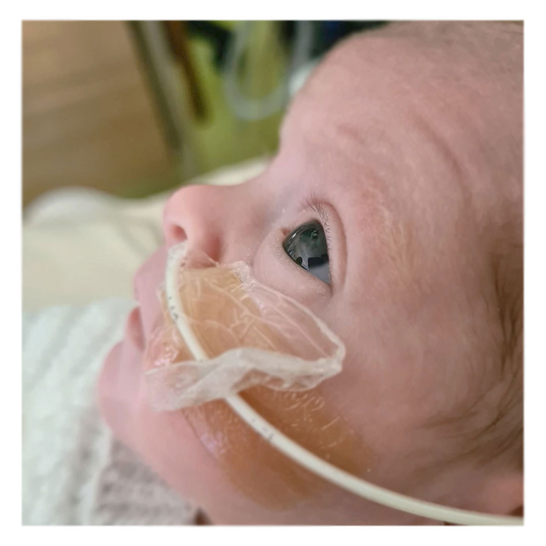 A Day in the Life of a Preemie Baby